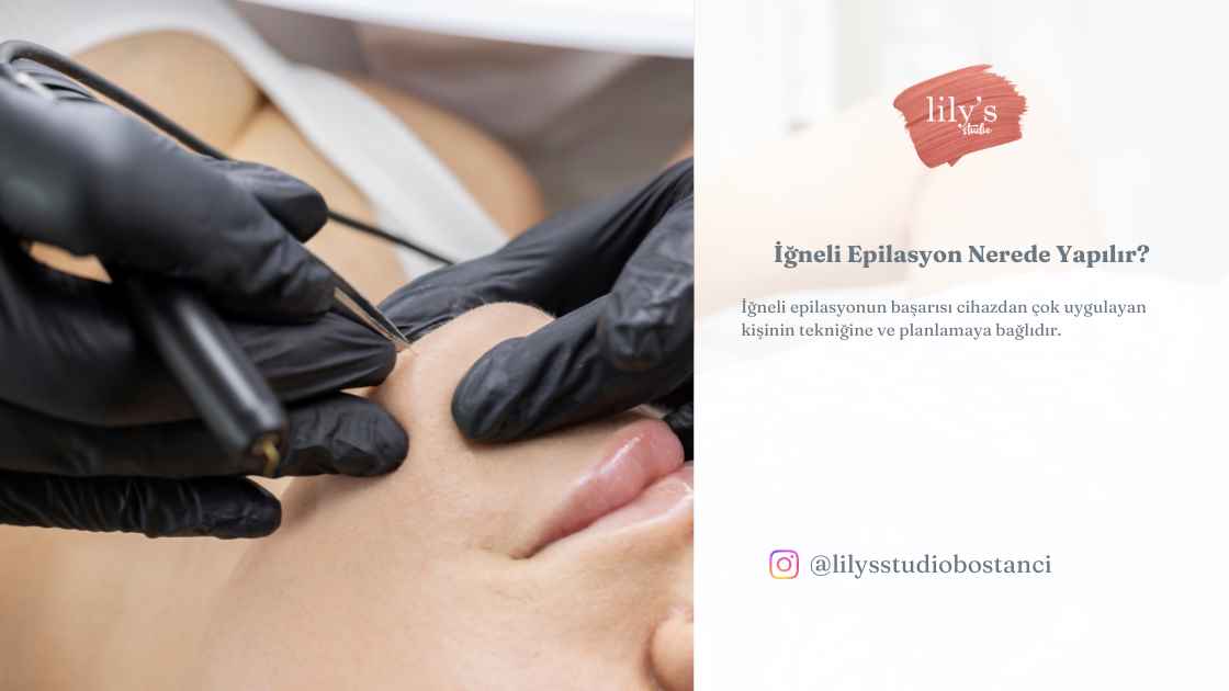 Kadıköy Bostancı’da iğneli epilasyon rehberi