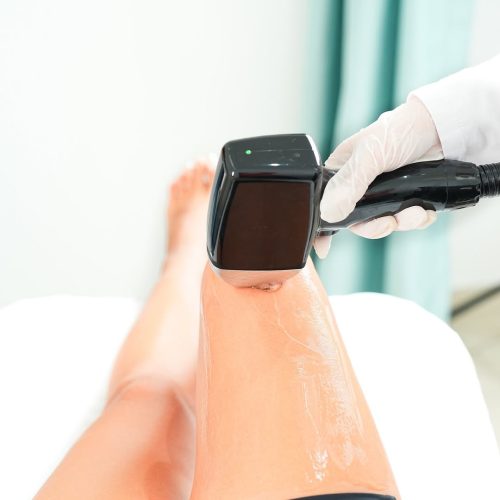 Bostancı lazer epilasyon merkezi Lily’s Beauty Studio uygulama alanı